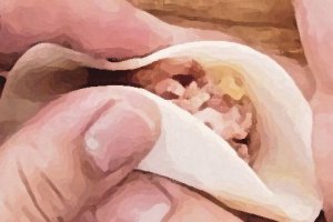 餛飩怎么炸著吃 炸餛飩用不用先煮熟