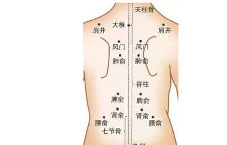 拔罐祛濕位置圖解 自己在家拔火罐怎么拔 2