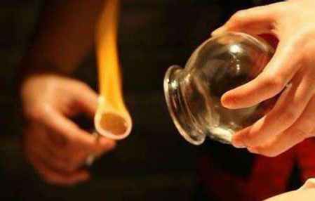 拔罐祛濕位置圖解 自己在家拔火罐怎么拔 1