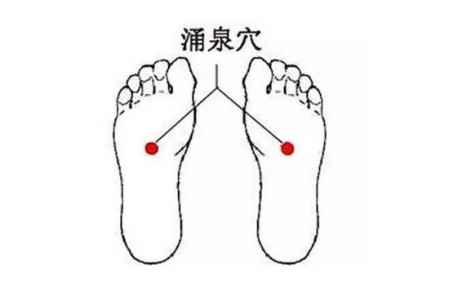 拔罐祛濕位置圖解 自己在家拔火罐怎么拔 3