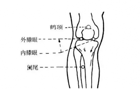 膝蓋疼拔罐拔哪里圖解 不同穴位的效果 3