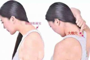 感冒艾灸灸哪個部位好 不同感冒癥狀的艾灸部位