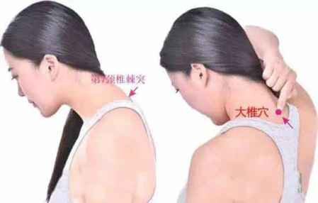 感冒艾灸灸哪個部位好 不同感冒癥狀的艾灸部位 1