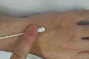輸液拔針的正確方法 輸液拔針的最佳時間