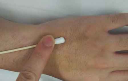 輸液拔針的正確方法 輸液拔針的最佳時間 1