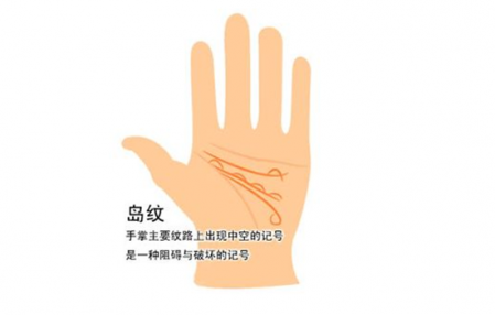 事業(yè)線上有一個大島紋代表什么 事業(yè)線島紋分析圖解 1