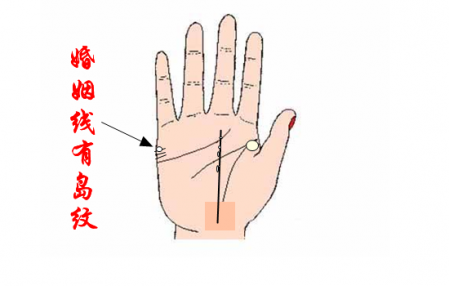 事業(yè)線上有一個大島紋代表什么 事業(yè)線島紋分析圖解 3