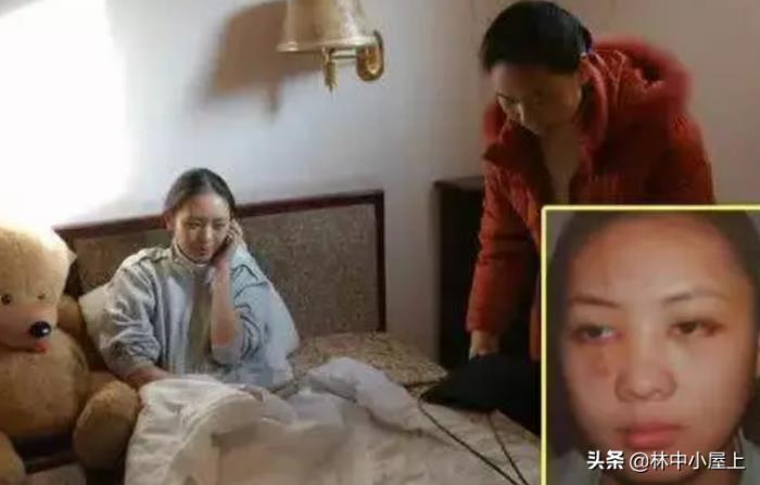 張默打童瑤到底真相 張默當(dāng)年為什么打童瑤 2