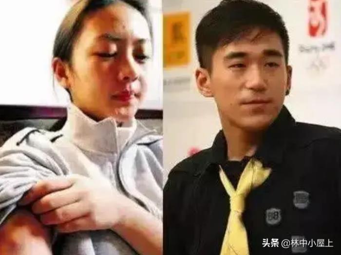 張默打童瑤到底真相 張默當(dāng)年為什么打童瑤 1