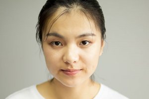 臉部怎樣補充膠原蛋白 臉上膠原蛋白流失怎么補