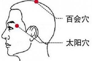偏頭痛的中醫治療方法怎么樣 偏頭痛中醫中藥治療