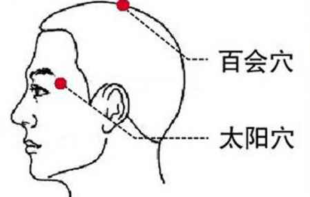 偏頭痛的中醫治療方法怎么樣 偏頭痛中醫中藥治療 1