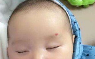 神仙轉世胎記的位置大全 神仙下凡的標志 1