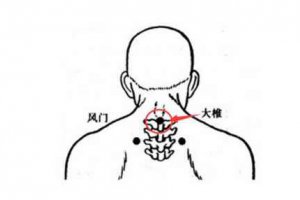 風(fēng)寒感冒艾灸大椎穴效果較好