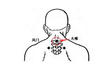 風寒感冒艾灸大椎穴效果較好 1